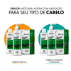Vichy Dercos Shampoo Anticaspa DS Cabelos Normais e Oleosos 300g 7908615087610 2.png